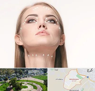 لیفت صورت با نخ در مهرشهر کرج 