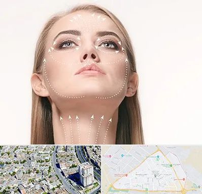 لیفت صورت با نخ در قاسم آباد مشهد 