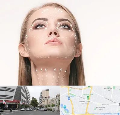 لیفت صورت با نخ در بلوار فردوس 