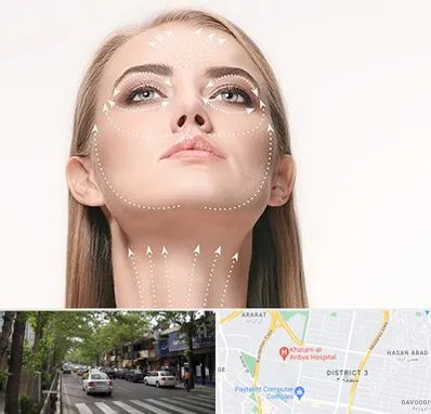 لیفت صورت با نخ در ظفر 