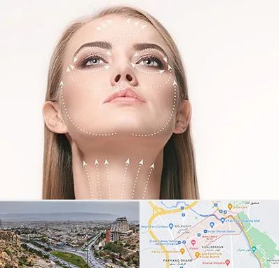 لیفت صورت با نخ در معالی آباد شیراز