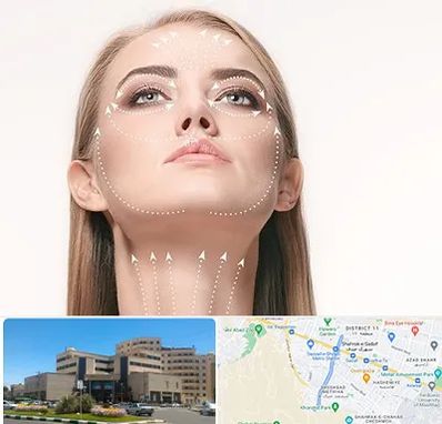 لیفت صورت با نخ در صیاد شیرازی مشهد