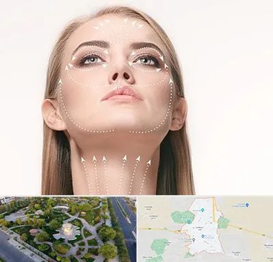 لیفت صورت با نخ در کاشمر