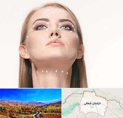 لیفت صورت با نخ در خراسان شمالی