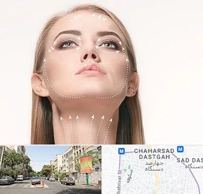 لیفت صورت با نخ در چهارصد دستگاه 