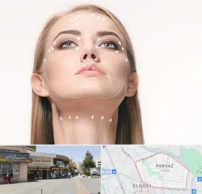 لیفت صورت با نخ در پرواز تبریز