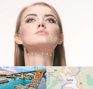 لیفت صورت با نخ در دزفول