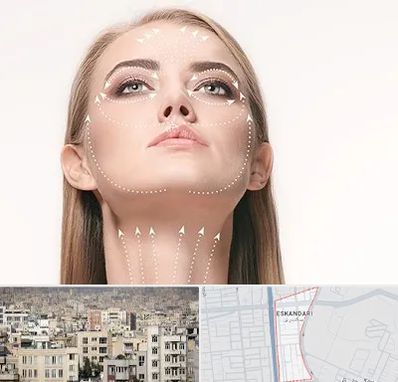 لیفت صورت با نخ در اسکندری