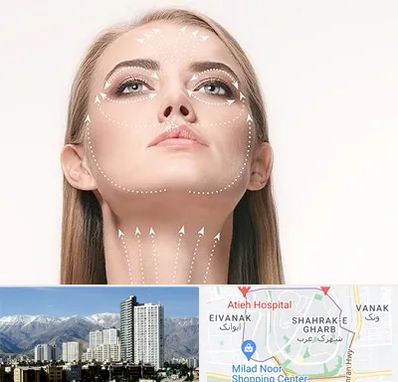 لیفت صورت با نخ در شهرک غرب 