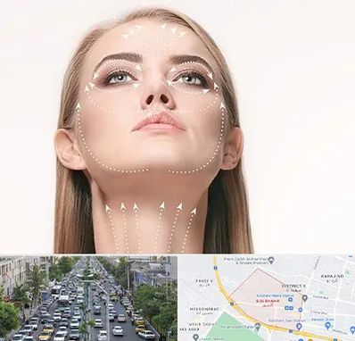 لیفت صورت با نخ در گلشهر کرج