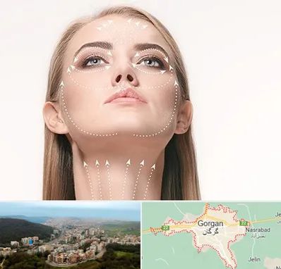 لیفت صورت با نخ در گرگان