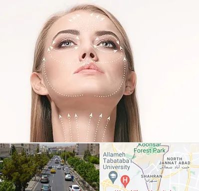 لیفت صورت با نخ در شهران 