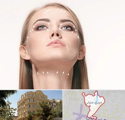 لیفت صورت با نخ در مینی سیتی