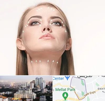 لیفت صورت با نخ در الهیه 