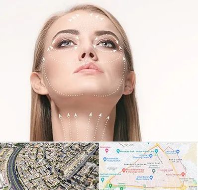 لیفت صورت با نخ در شهرک غرب مشهد