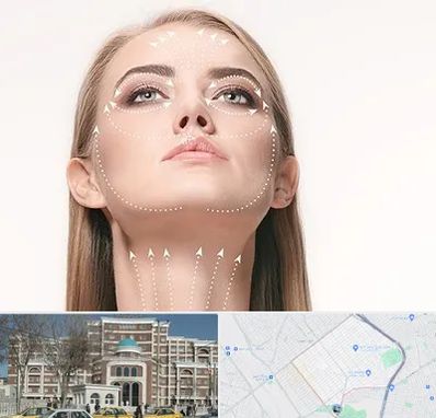 لیفت صورت با نخ در طلاب مشهد