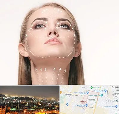 لیفت صورت با نخ در مارلیک کرج