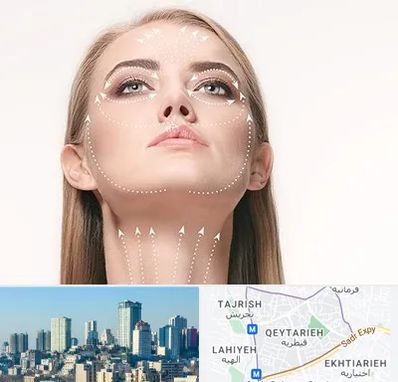 لیفت صورت با نخ در قیطریه 