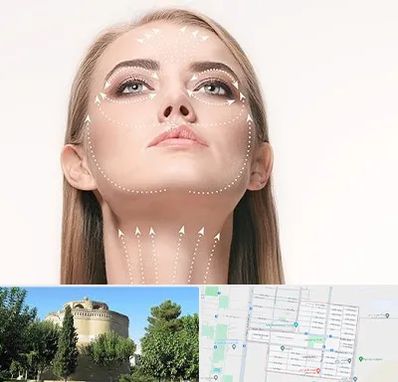 لیفت صورت با نخ در مرداویج اصفهان