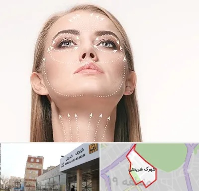 لیفت صورت با نخ در شهرک شریعتی