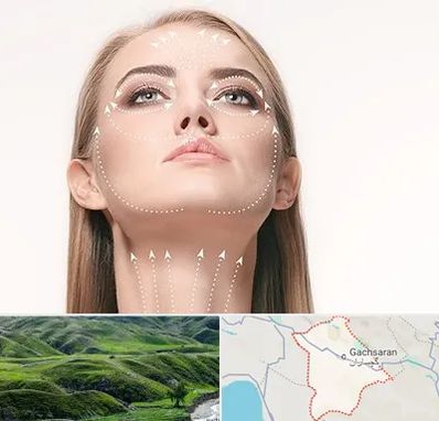 لیفت صورت با نخ در گچساران