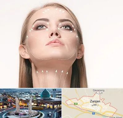 لیفت صورت با نخ در زنجان