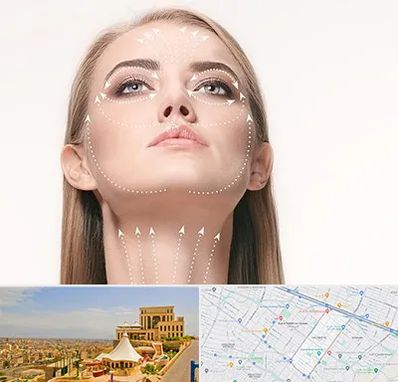 لیفت صورت با نخ در هاشمیه مشهد