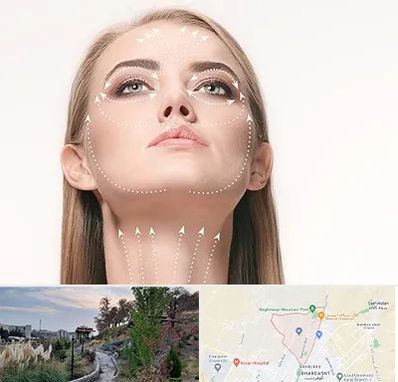 لیفت صورت با نخ در باغستان کرج