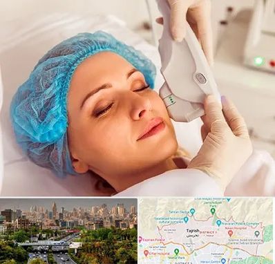 اکسنت در منطقه 1 تهران 