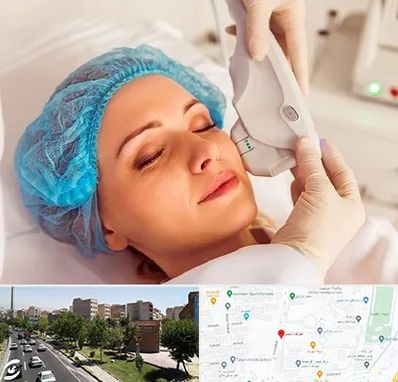 اکسنت در شهرک آزمایش 