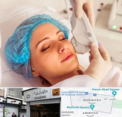 اکسنت در منیریه 