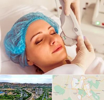 اکسنت در شهریار