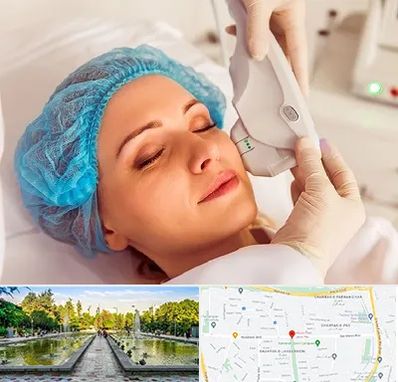 اکسنت در سرسبز 