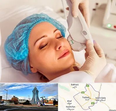 اکسنت در تایباد