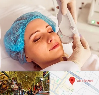 اکسنت در بازار وکیل شیراز