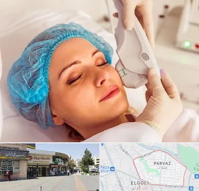 اکسنت در پرواز تبریز