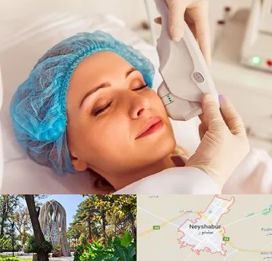 اکسنت در نیشابور