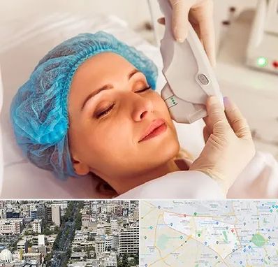 اکسنت در منطقه 18 تهران 