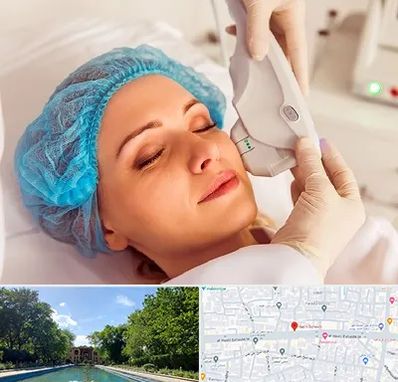 اکسنت در هشت بهشت اصفهان