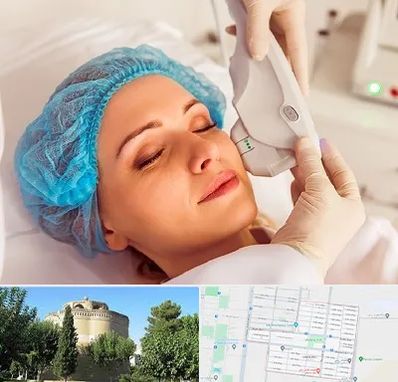 اکسنت در مرداویج اصفهان