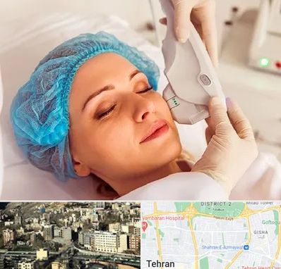 اکسنت در مرزداران 