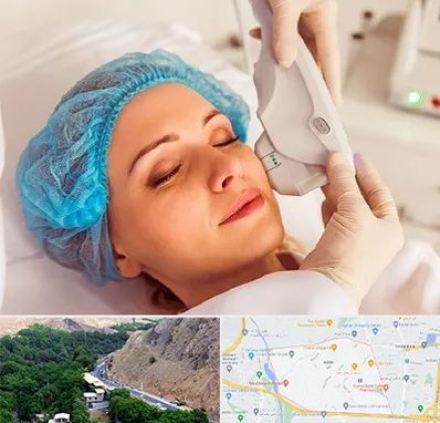 اکسنت در کن 