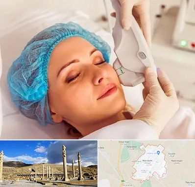 اکسنت در مرودشت