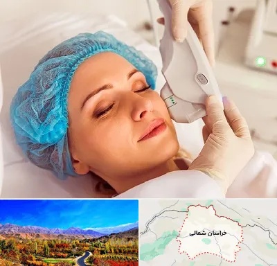 اکسنت در خراسان شمالی