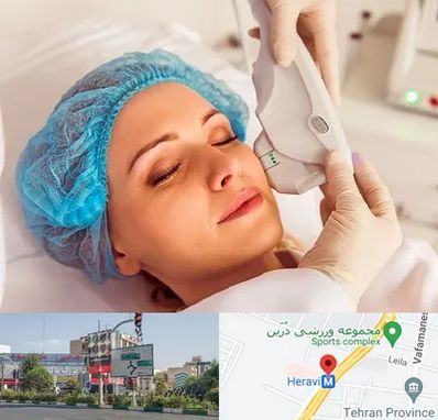 اکسنت در هروی 