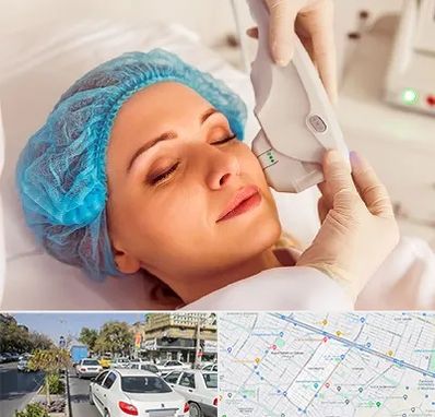 اکسنت در مفتح مشهد