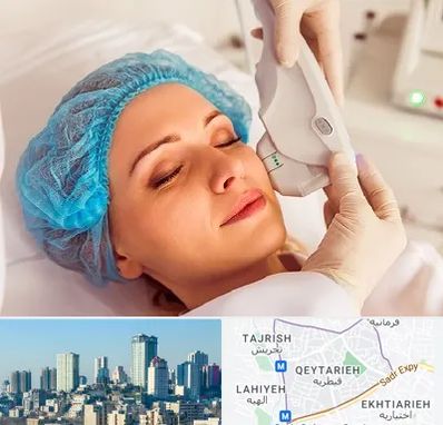 اکسنت در قیطریه 