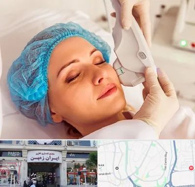 اکسنت در ایران زمین