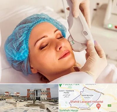 اکسنت در حکیمیه 