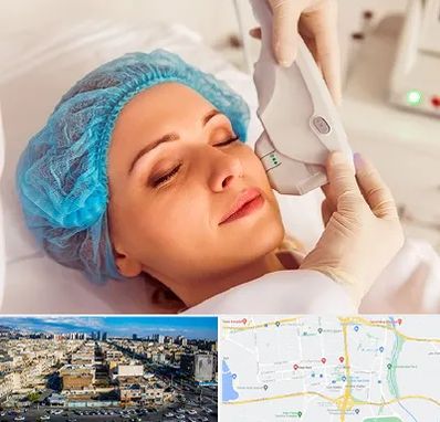 اکسنت در شهرک راه آهن